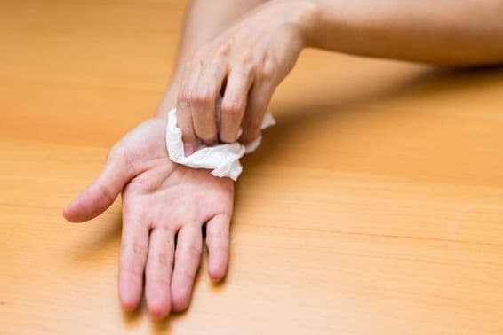 Žena trpiaca spotenými rukami.